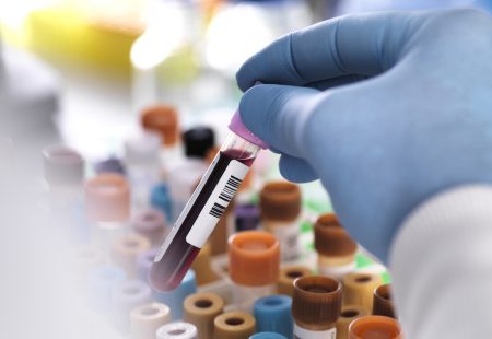 Cropped hand of laboratory technician holding blood sample for medical testing